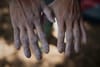 Two hands covered in chalk, likely from rock climbing, with visible wear and dirt